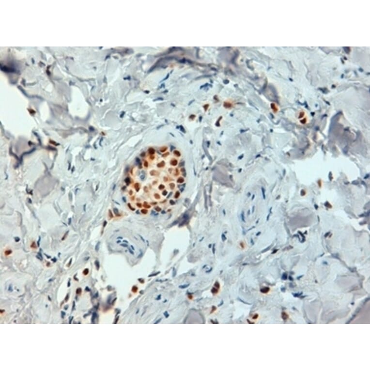 Immunohistochemistry - Anti-Estrogen Receptor alpha Antibody [6F11] (A279486) - Antibodies.com