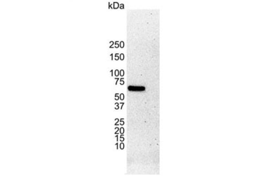 Western Blot - Anti-Estrogen Receptor alpha Antibody [6F11] (A279486) - Antibodies.com