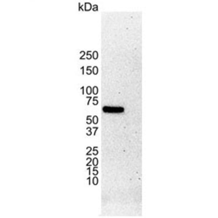 Western Blot - Anti-Estrogen Receptor alpha Antibody [6F11] (A279486) - Antibodies.com