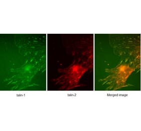 SDS-PAGE - Anti-Talin 1 Antibody [97H6] (A279556) - Antibodies.com