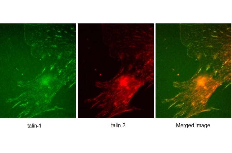 SDS-PAGE - Anti-Talin 1 Antibody [97H6] (A279556) - Antibodies.com