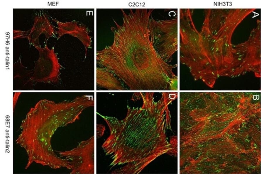 Immunohistochemistry - Anti-Talin 1 Antibody [97H6] (A279556) - Antibodies.com