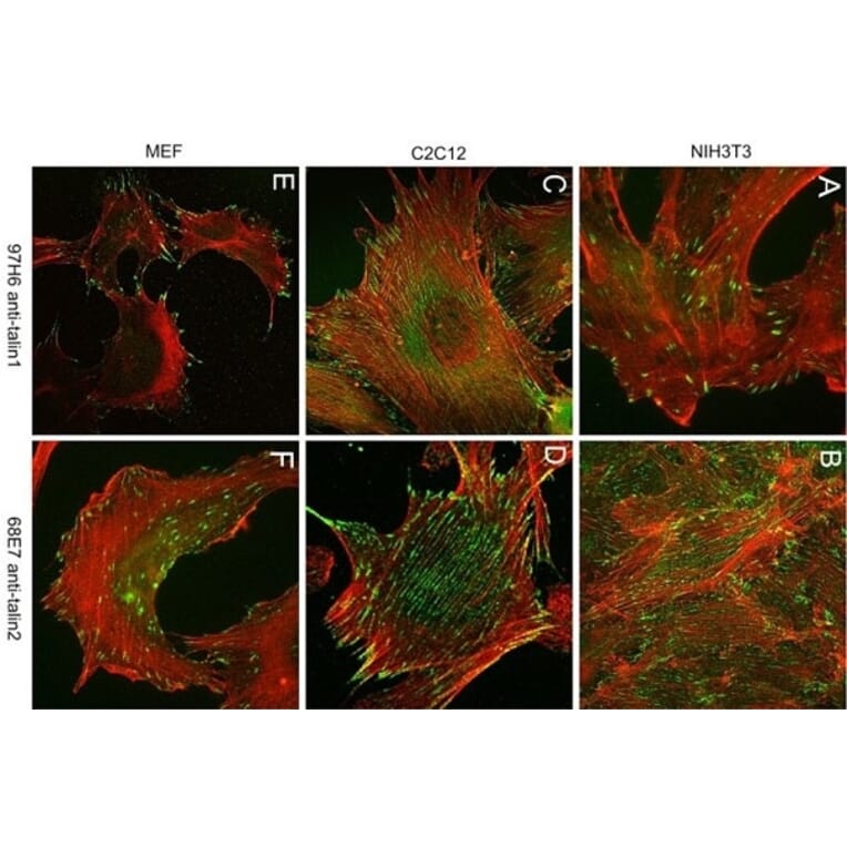 Immunohistochemistry - Anti-Talin 1 Antibody [97H6] (A279556) - Antibodies.com