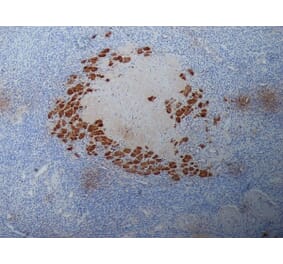 Immunohistochemistry - Anti-Progesterone Antibody [9B4] (A279565) - Antibodies.com