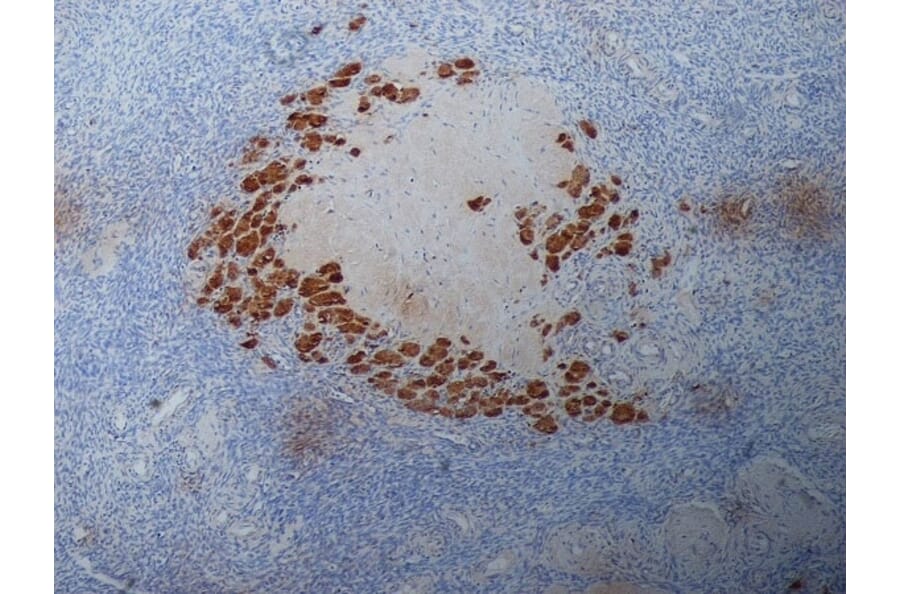 Immunohistochemistry - Anti-Progesterone Antibody [9B4] (A279565) - Antibodies.com