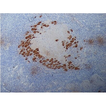 Immunohistochemistry - Anti-Progesterone Antibody [9B4] (A279565) - Antibodies.com
