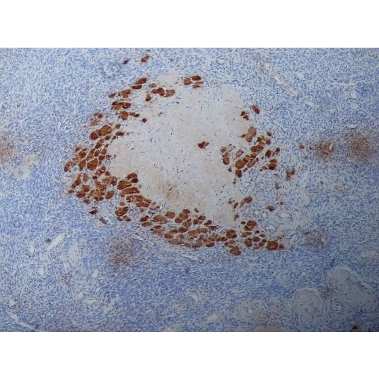 Immunohistochemistry - Anti-Progesterone Antibody [9B4] (A279565) - Antibodies.com