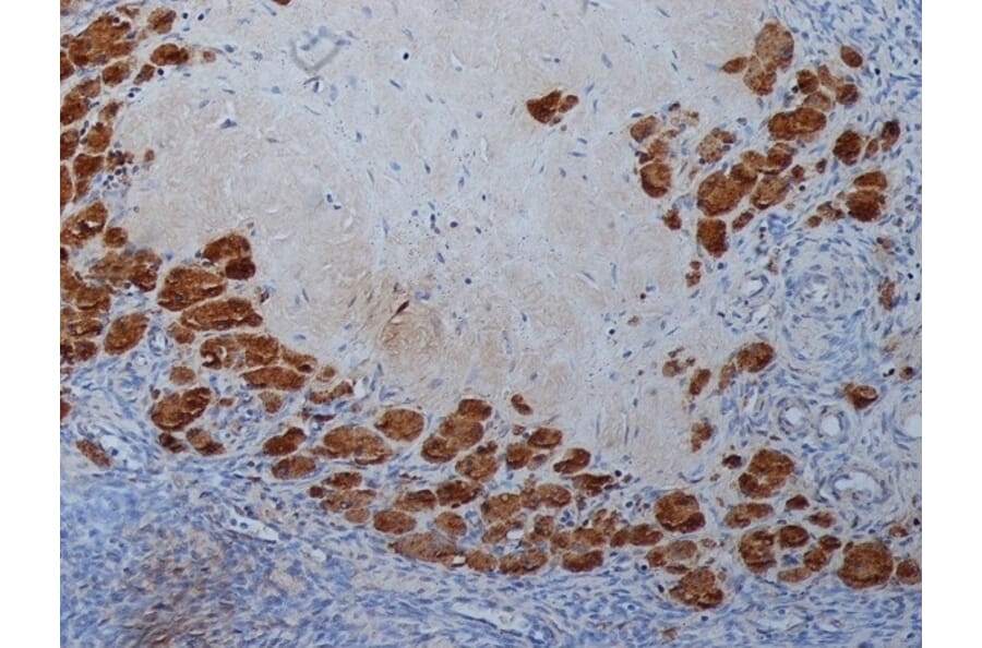 Immunohistochemistry - Anti-Progesterone Antibody [9B4] (A279565) - Antibodies.com
