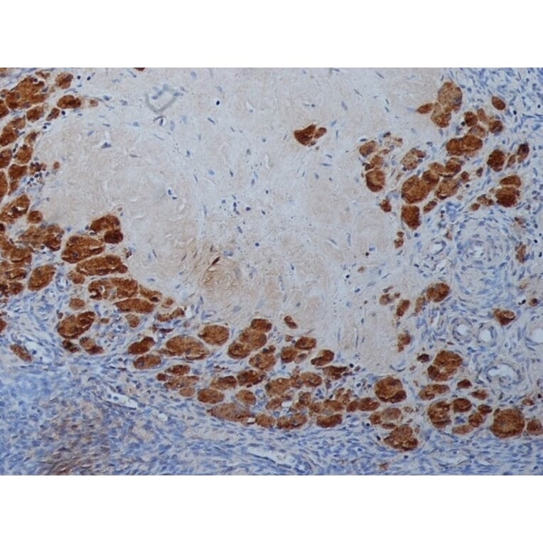 Immunohistochemistry - Anti-Progesterone Antibody [9B4] (A279565) - Antibodies.com