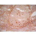 Immunohistochemistry - Anti-LRP1 Antibody [A2Mr alpha-2] (A279602) - Antibodies.com