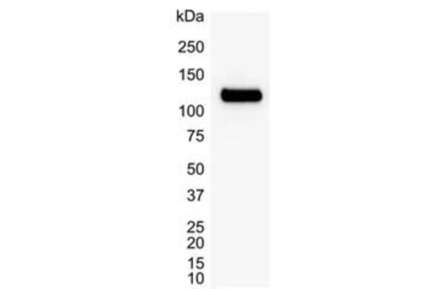 Western Blot - Anti-PARP1 Antibody [A6.4.12] (A279609) - Antibodies.com