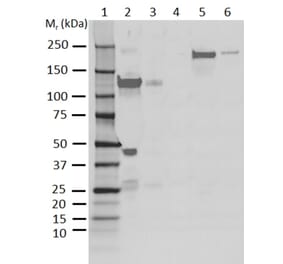 Western Blot - Anti-C3 Antibody [AB01-3B4] (A279621) - Antibodies.com