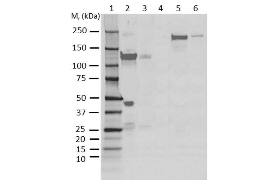 Western Blot - Anti-C3 Antibody [AB01-3B4] (A279621) - Antibodies.com