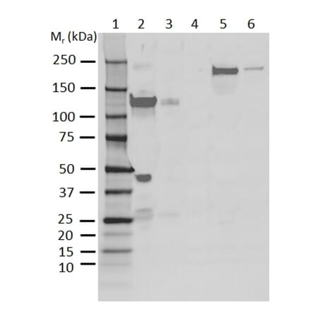 Western Blot - Anti-C3 Antibody [AB01-3B4] (A279621) - Antibodies.com