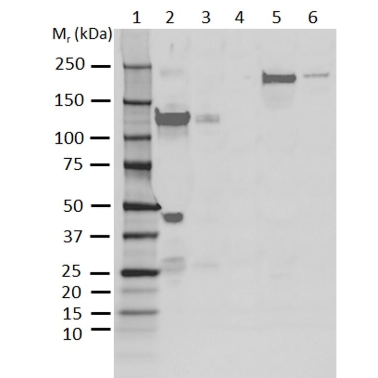 Western Blot - Anti-C3 Antibody [AB01-3B4] (A279621) - Antibodies.com