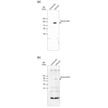 Western Blot - Anti-His Tag Antibody [ABD2.2.20] (HRP) (A279628) - Antibodies.com