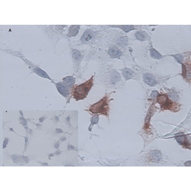 Immunocytochemistry - Anti-CD34 Antibody [AV138] (A279715) - Antibodies.com