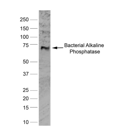 Western Blot - Anti-Alkaline Phosphatase Antibody [BGN/03/662] (A279818) - Antibodies.com
