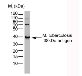 Western Blot - Anti-Mycobacterium tuberculosis Antibody [BGN/1209/3875] (A279824) - Antibodies.com