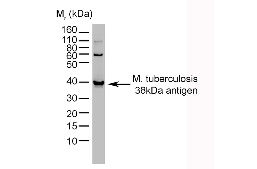 Western Blot - Anti-Mycobacterium tuberculosis Antibody [BGN/1209/3875] (A279824) - Antibodies.com