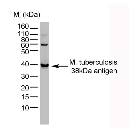 Western Blot - Anti-Mycobacterium tuberculosis Antibody [BGN/1209/3875] (A279824) - Antibodies.com