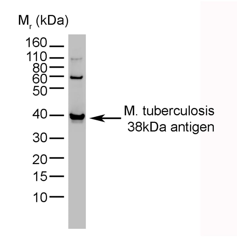 Western Blot - Anti-Mycobacterium tuberculosis Antibody [BGN/1209/3875] (A279824) - Antibodies.com