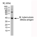 Western Blot - Anti-Mycobacterium tuberculosis Antibody [BGN/1209/3875] (A279824) - Antibodies.com