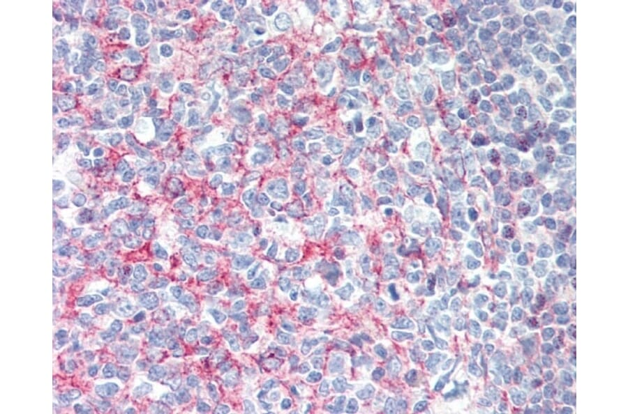 Immunohistochemistry - Anti-CD21 Antibody [Bu33] (A279891) - Antibodies.com