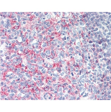 Immunohistochemistry - Anti-CD21 Antibody [Bu33] (A279891) - Antibodies.com