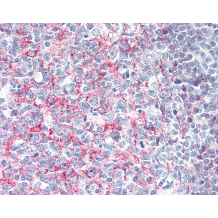 Immunohistochemistry - Anti-CD21 Antibody [Bu33] (A279891) - Antibodies.com