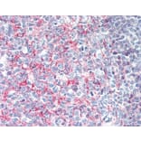 Immunohistochemistry - Anti-CD21 Antibody [Bu33] (A279891) - Antibodies.com