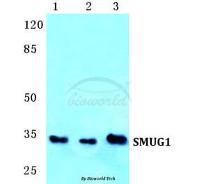 Anti-SMUG1 Antibody from Bioworld Technology (BS5753) - Antibodies.com