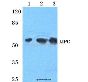 Anti-LIPC Antibody from Bioworld Technology (BS5756) - Antibodies.com