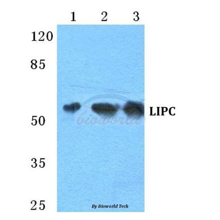 Anti-LIPC Antibody from Bioworld Technology (BS5756) - Antibodies.com