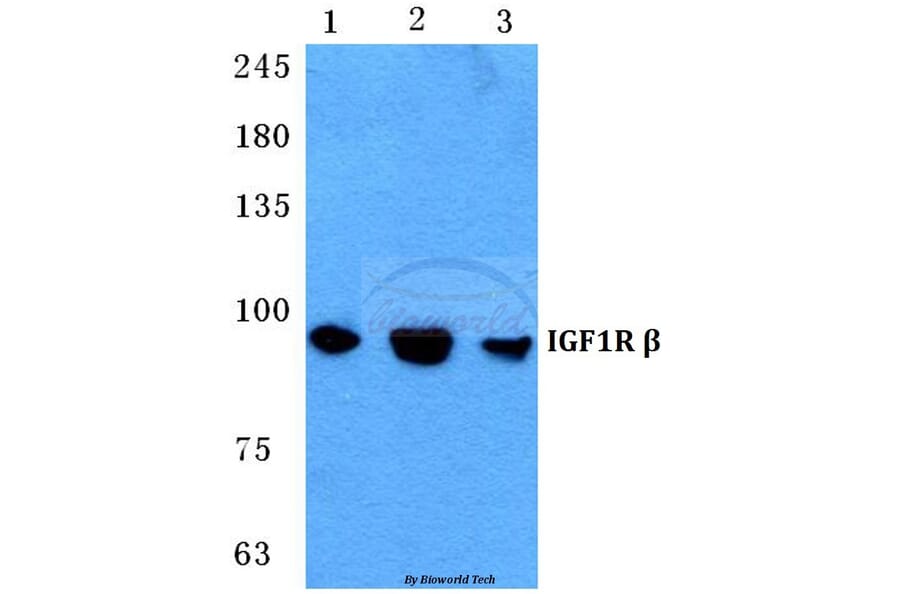 Anti-IGF-1R Antibody from Bioworld Technology (BS5763) - Antibodies.com