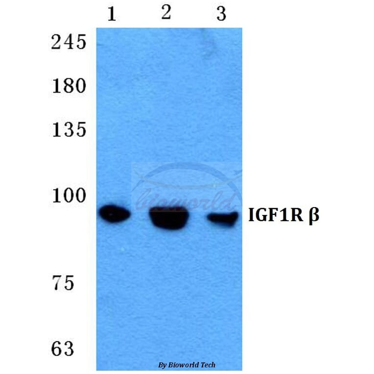Anti-IGF-1R Antibody from Bioworld Technology (BS5763) - Antibodies.com