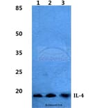 Anti-IL-4 Antibody from Bioworld Technology (BS5764) - Antibodies.com