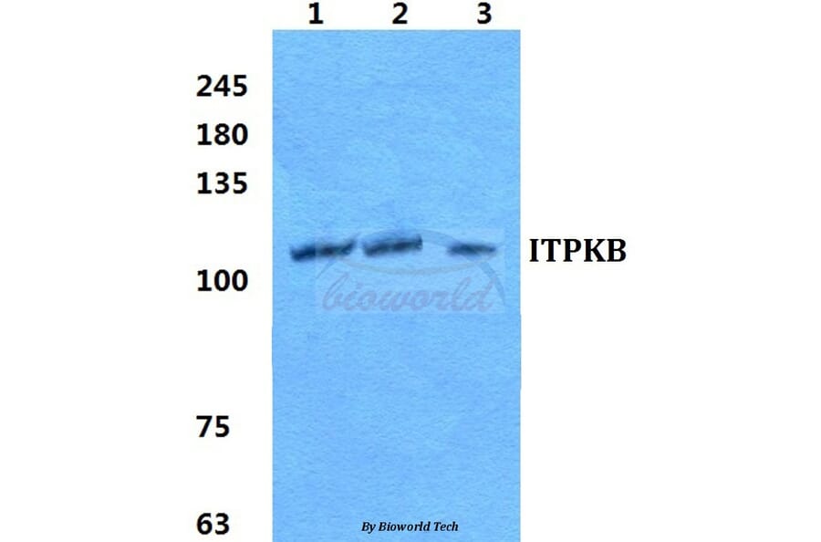 Anti-ITPKB Antibody from Bioworld Technology (BS5765) - Antibodies.com