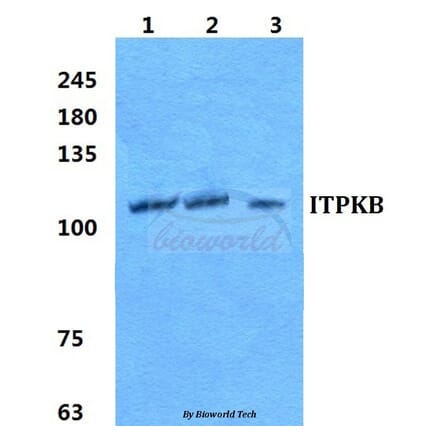 Anti-ITPKB Antibody from Bioworld Technology (BS5765) - Antibodies.com