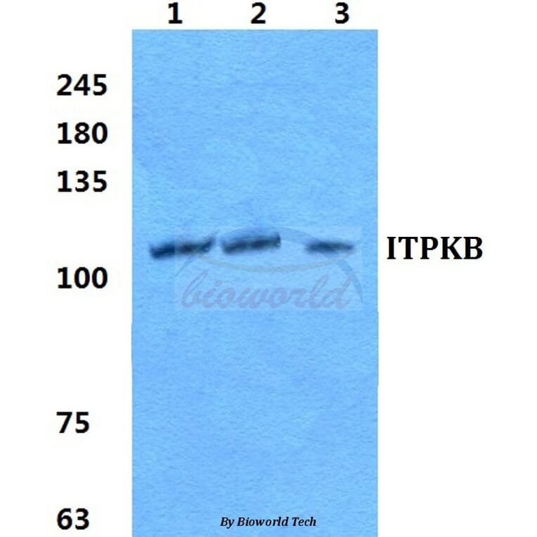 Anti-ITPKB Antibody from Bioworld Technology (BS5765) - Antibodies.com