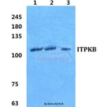 Anti-ITPKB Antibody from Bioworld Technology (BS5765) - Antibodies.com