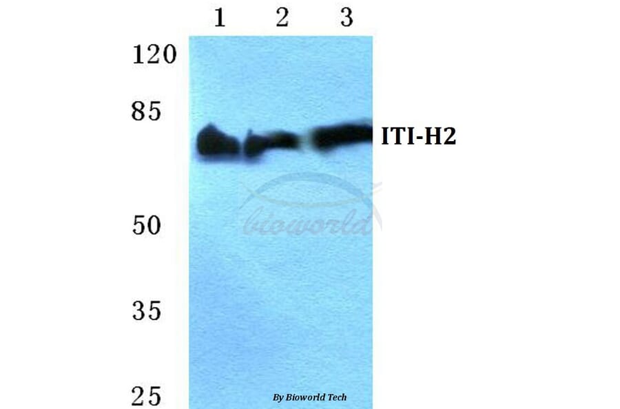 Anti-ITI-H2 Antibody from Bioworld Technology (BS5768) - Antibodies.com