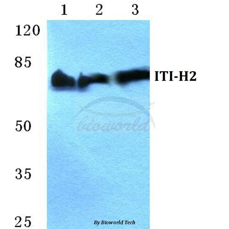 Anti-ITI-H2 Antibody from Bioworld Technology (BS5768) - Antibodies.com