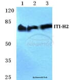 Anti-ITI-H2 Antibody from Bioworld Technology (BS5768) - Antibodies.com