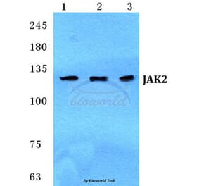 Anti-JAK2 Antibody from Bioworld Technology (BS5769) - Antibodies.com