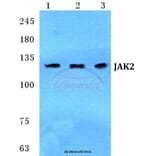 Anti-JAK2 Antibody from Bioworld Technology (BS5769) - Antibodies.com