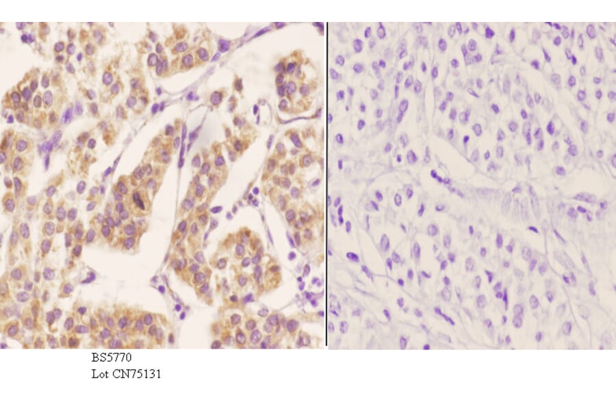 Anti-ZC3H8 Antibody from Bioworld Technology (BS5770) - Antibodies.com