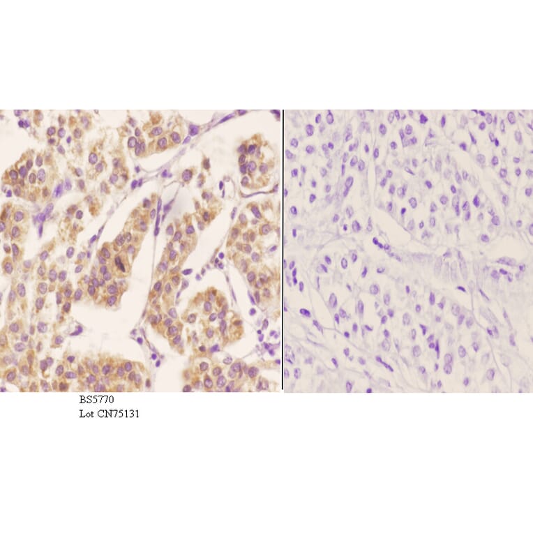 Anti-ZC3H8 Antibody from Bioworld Technology (BS5770) - Antibodies.com