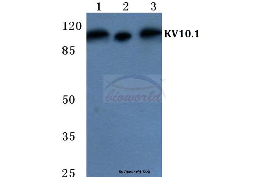 Anti-KV10.1 Antibody from Bioworld Technology (BS5772) - Antibodies.com