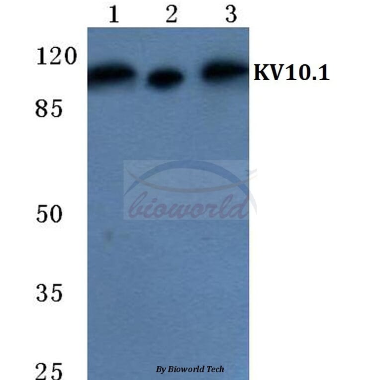 Anti-KV10.1 Antibody from Bioworld Technology (BS5772) - Antibodies.com